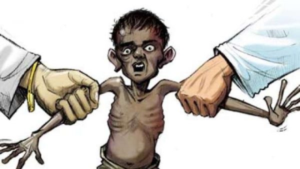 malnourishment